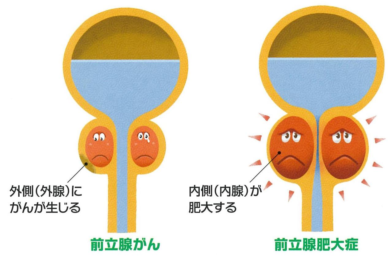 勃起不全ウルドゥー語の意味