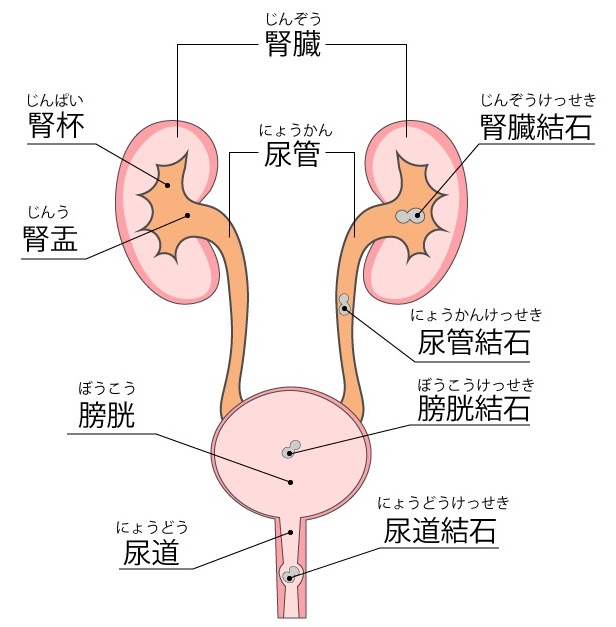 尿 路 結石 予防